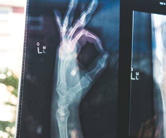 απαλλαγή στην ασφάλιση